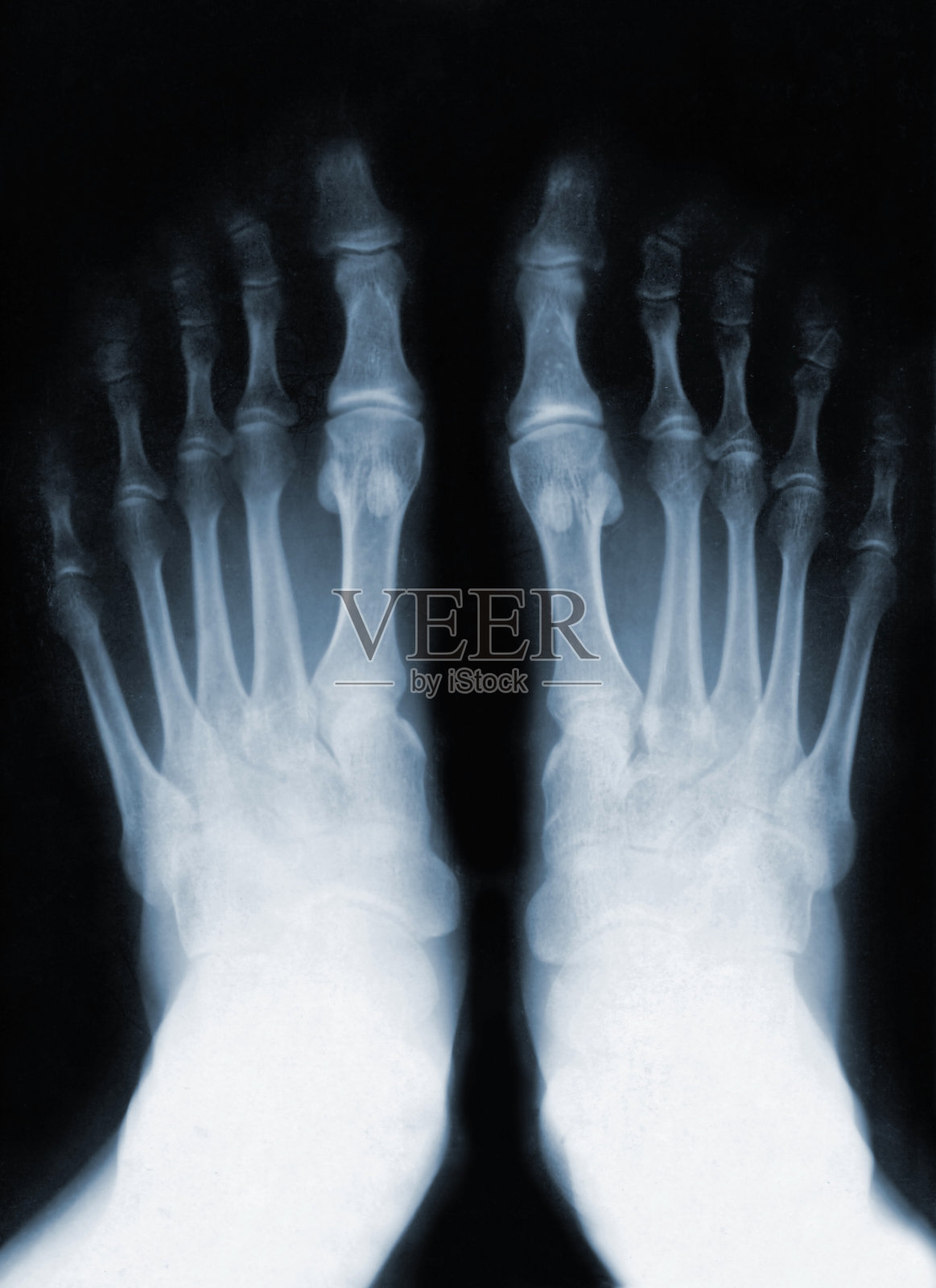 脚的手指照片摄影图片