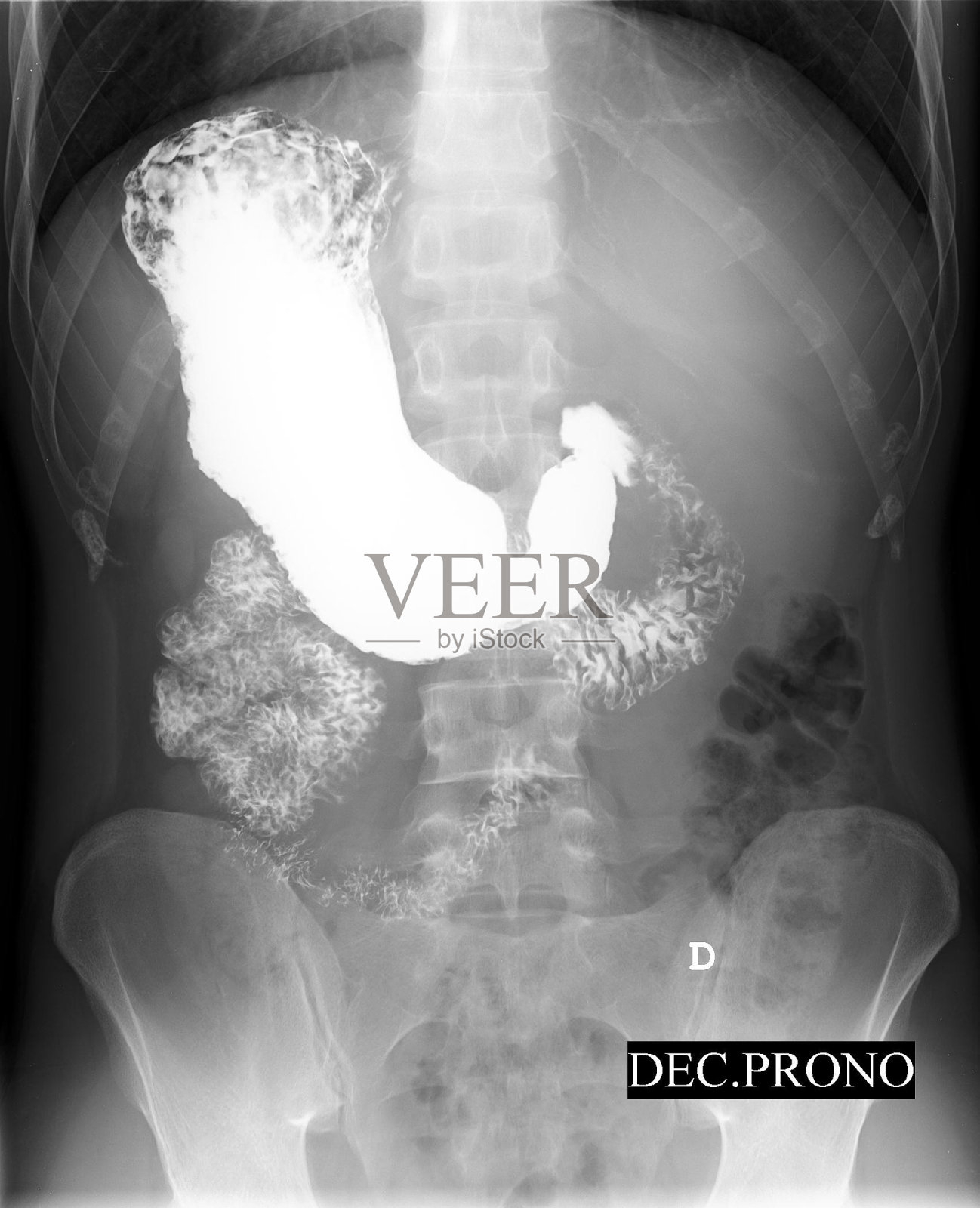 腹部x光照片摄影图片