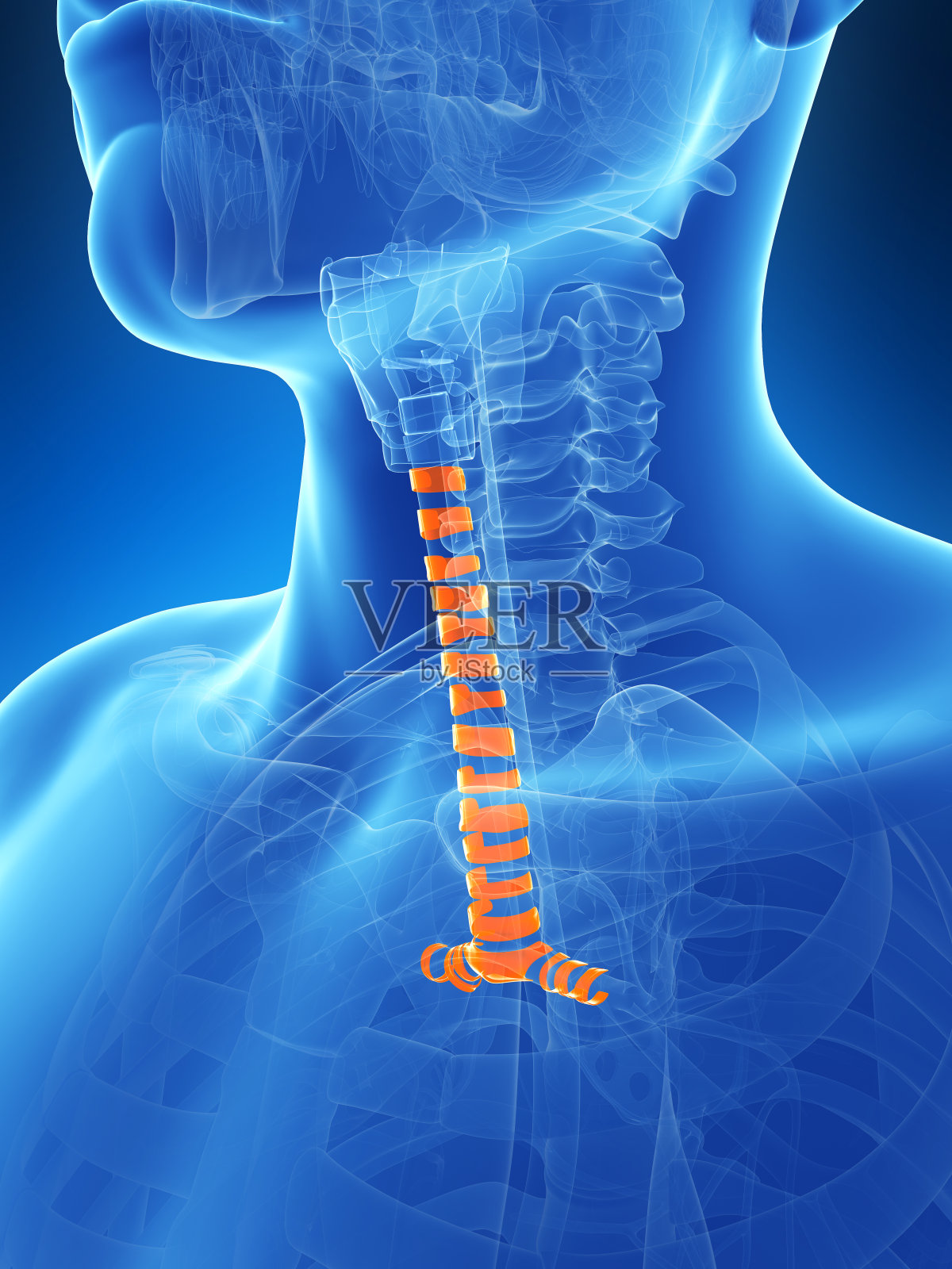 气管环照片摄影图片