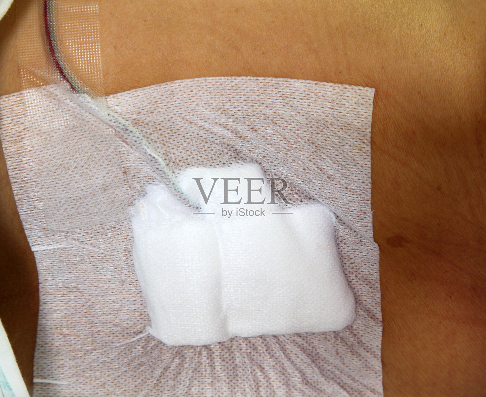 医用绷带照片摄影图片