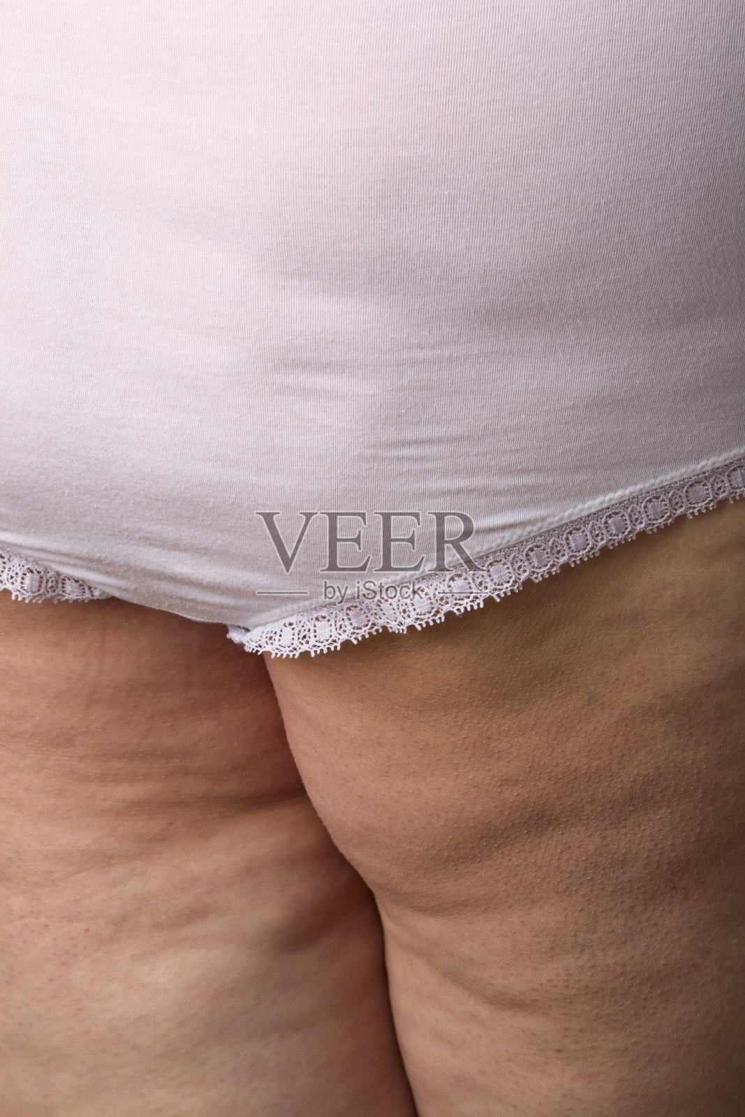 脂肪团照片摄影图片