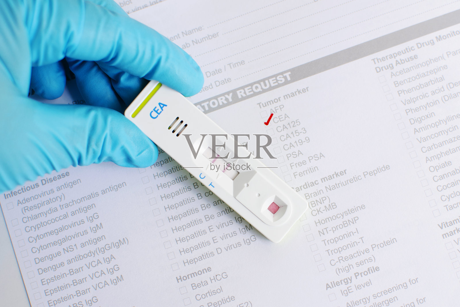 CEA阳性照片摄影图片