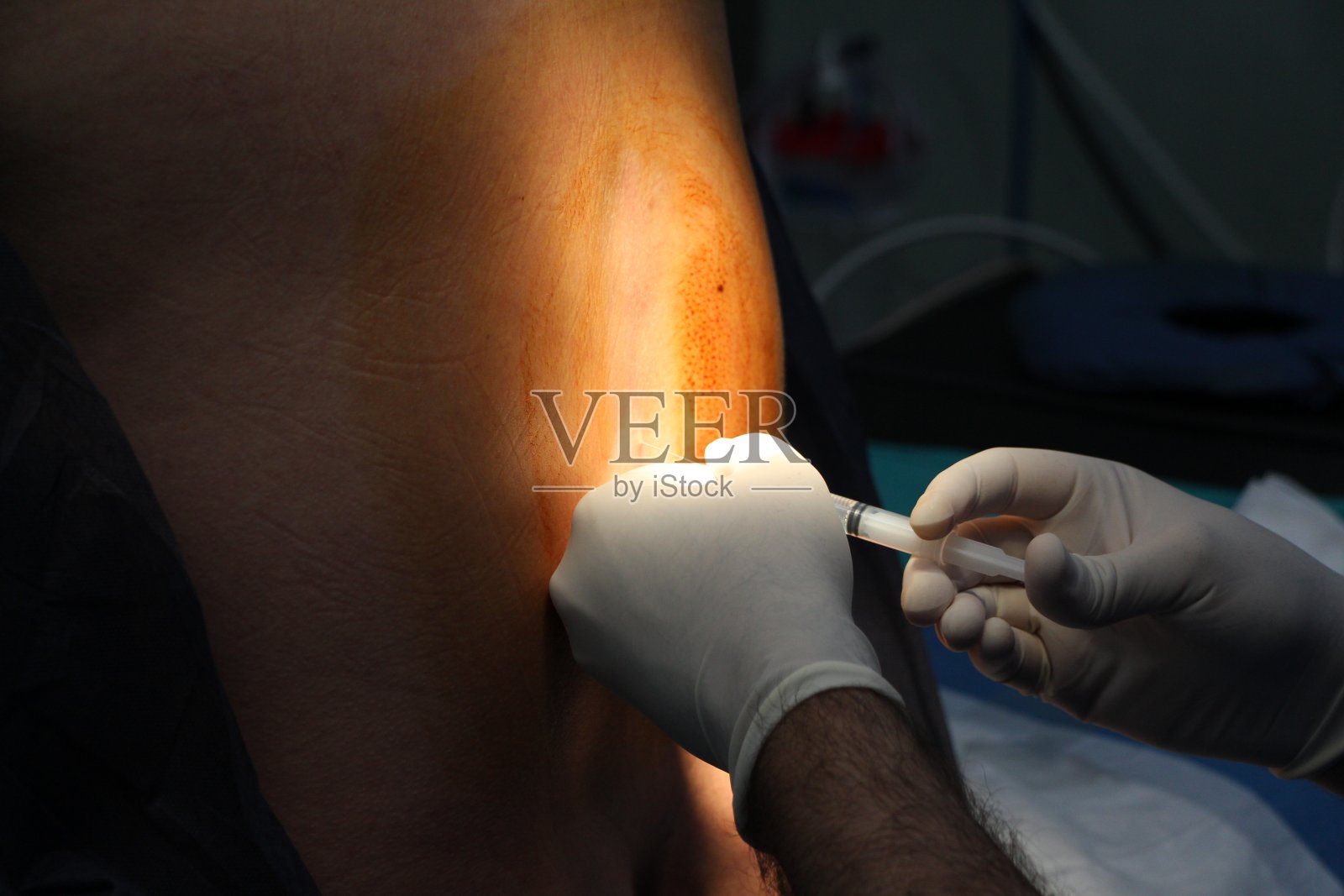 硬膜外麻醉照片摄影图片