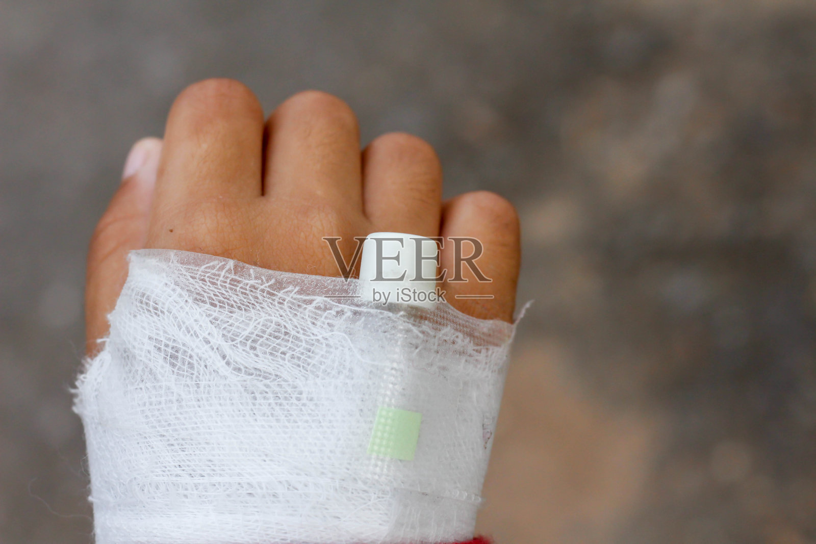 肝素锁定在儿童病人的手上照片摄影图片