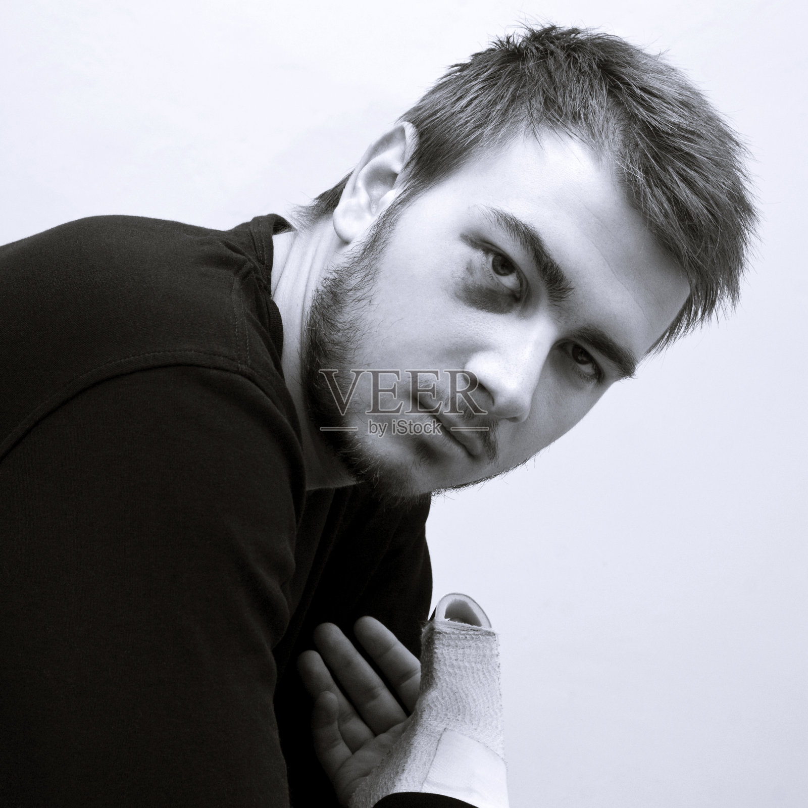 有瘀伤的年轻男人照片摄影图片