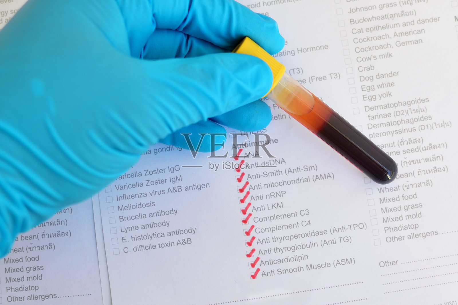 自身免疫系统测试照片摄影图片