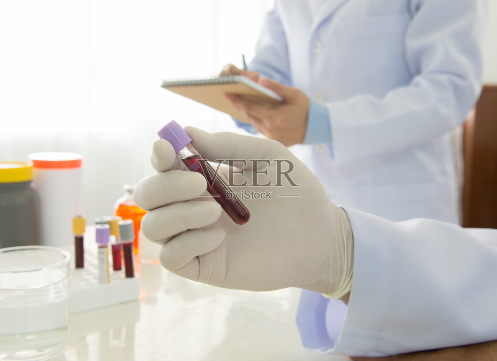 血液测试照片摄影图片