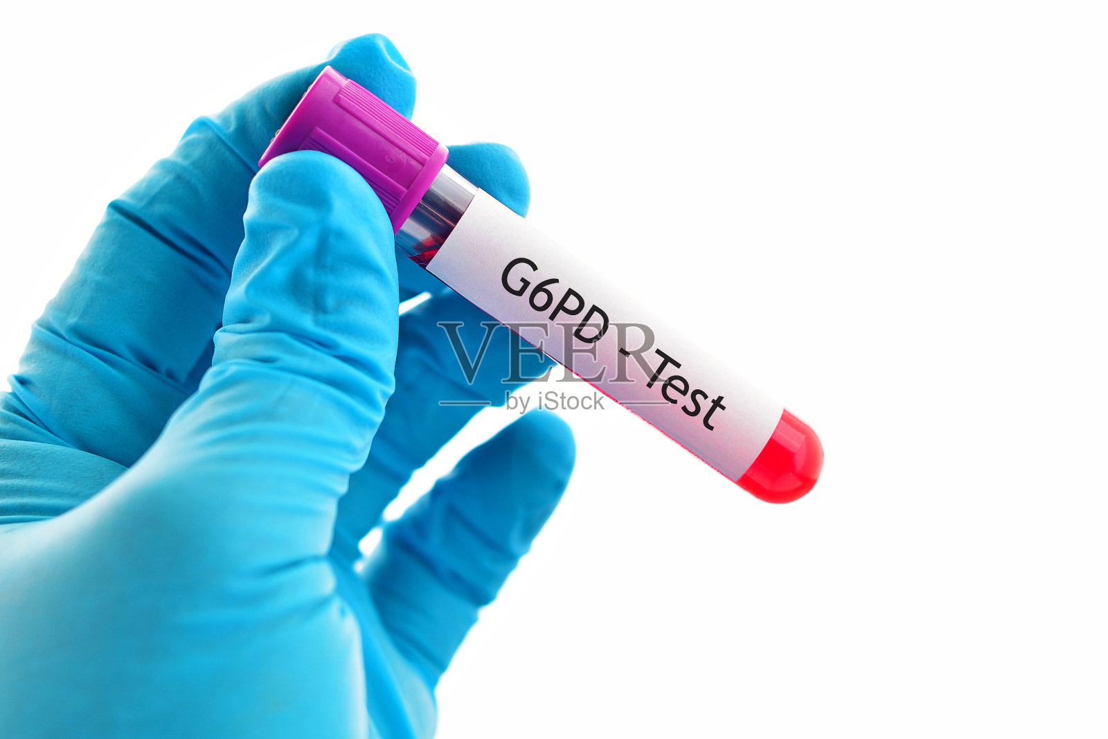 G6PD测试照片摄影图片