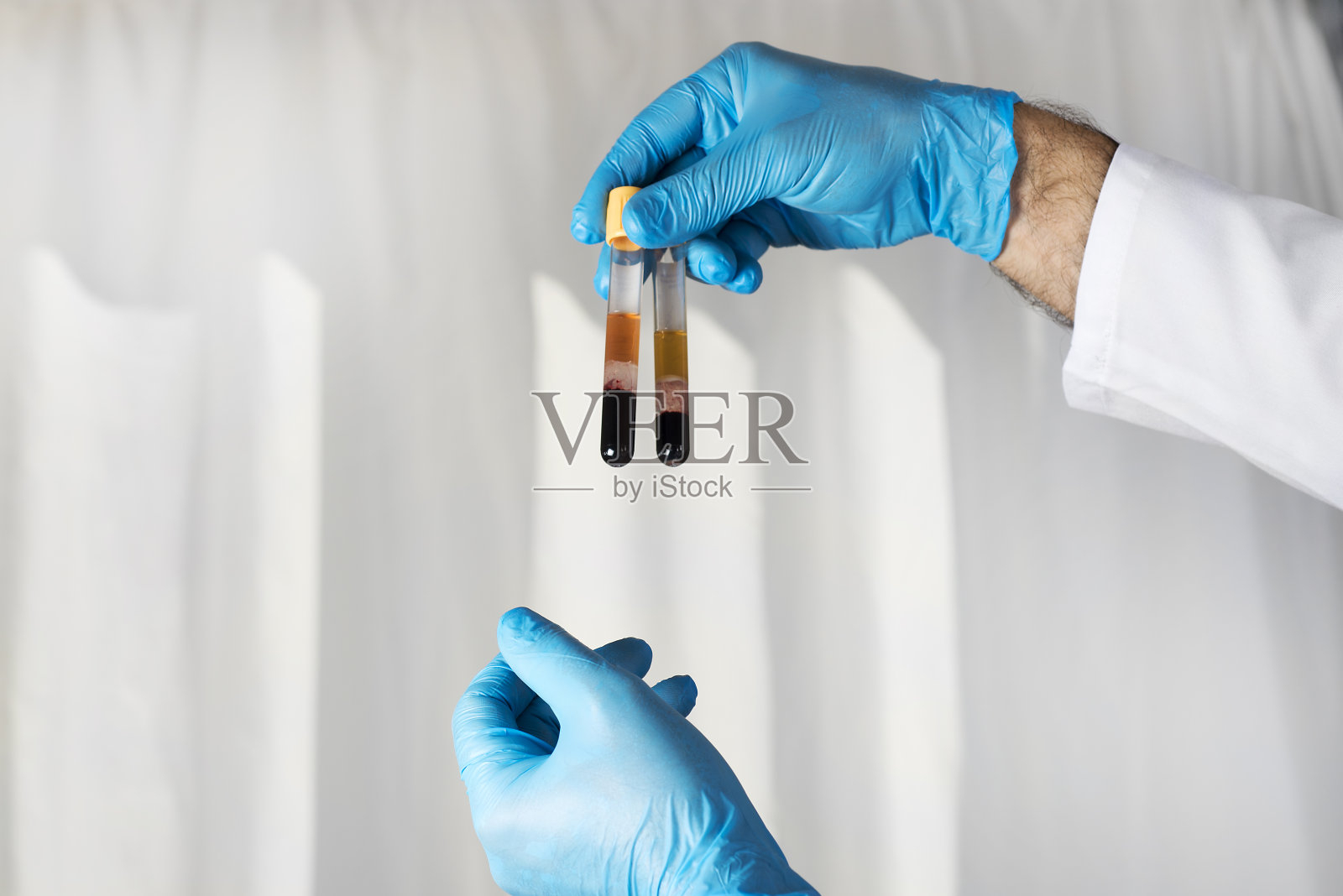 用于实验室检测的血管。照片摄影图片