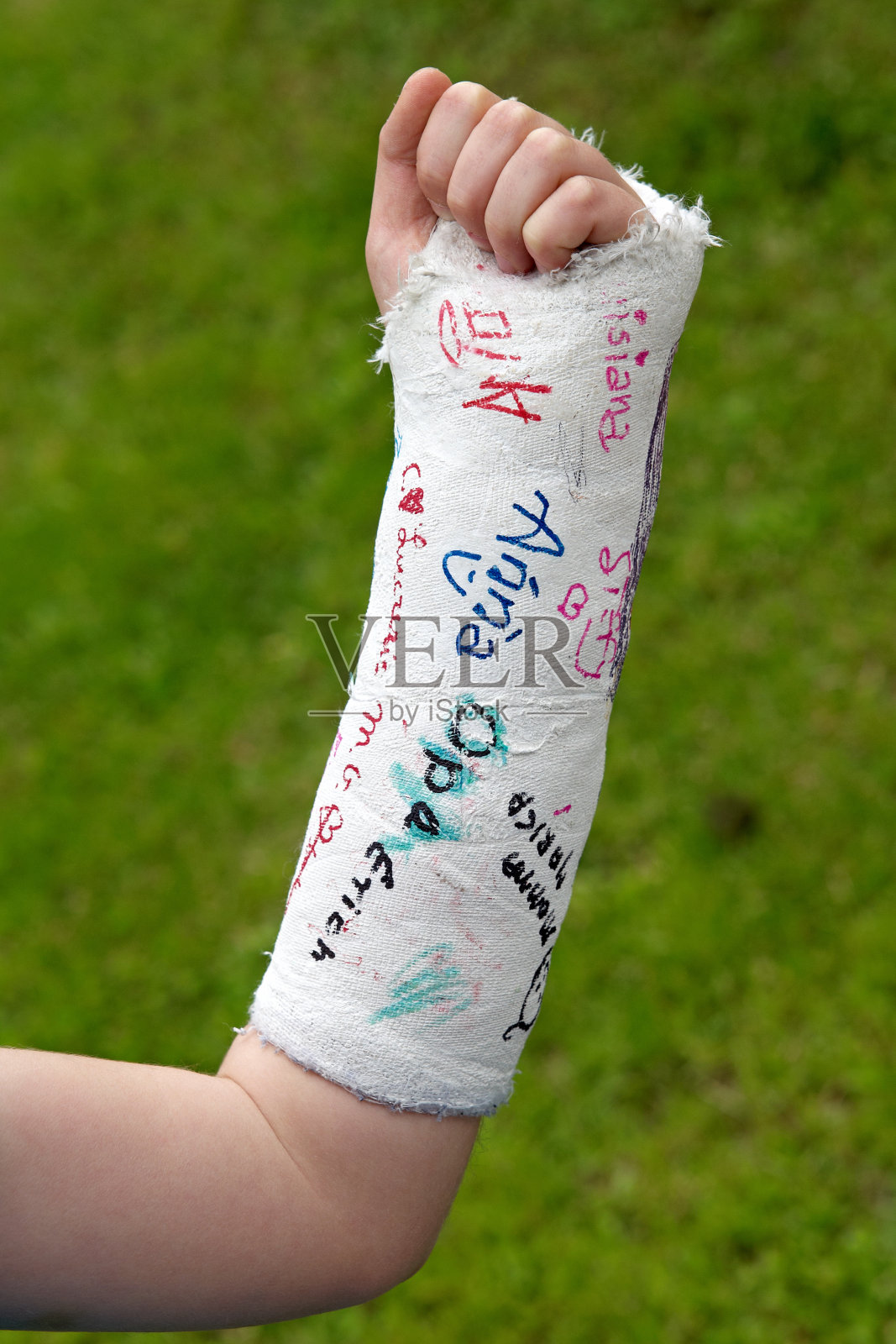 手臂骨折照片摄影图片