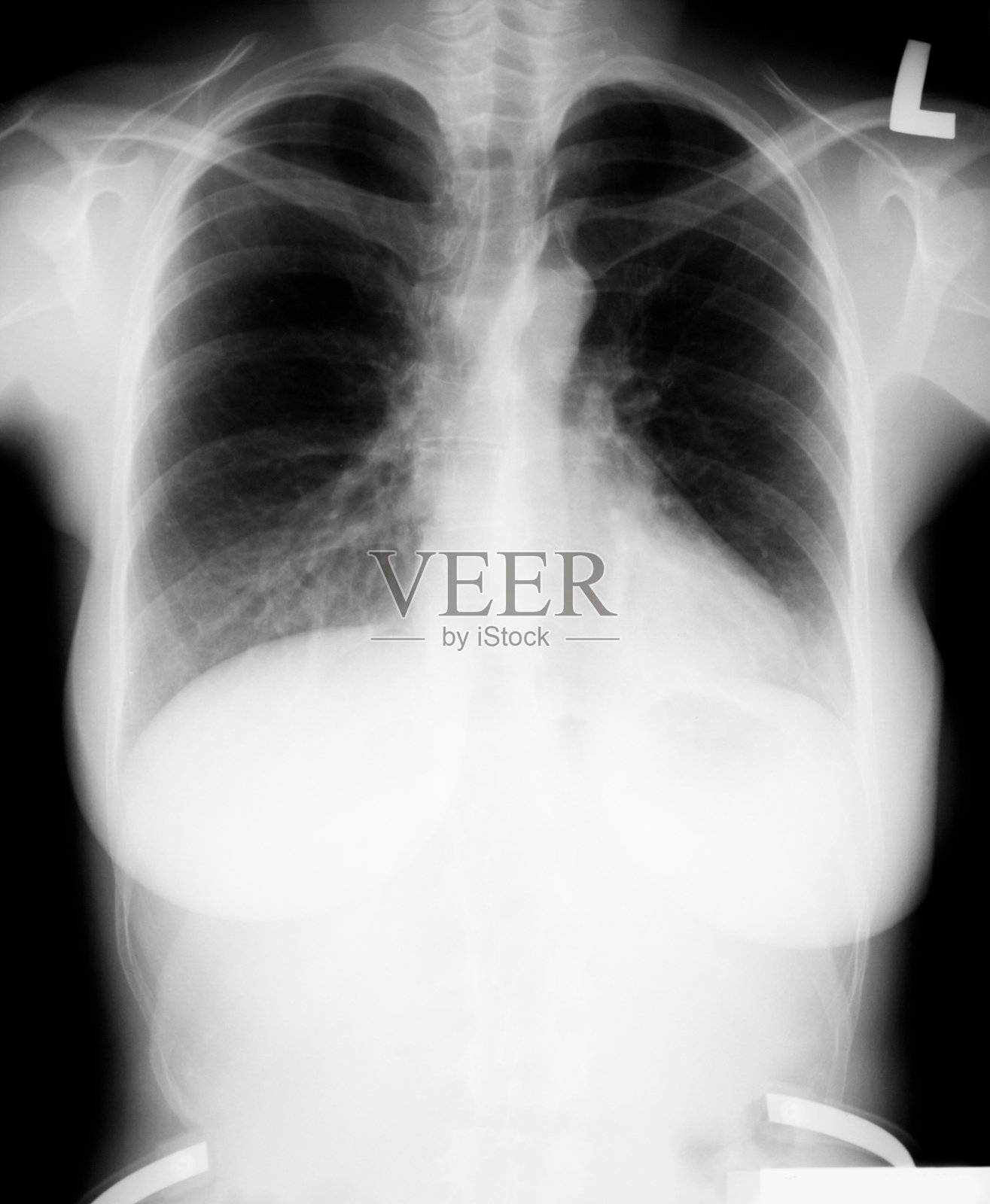 年轻X光技师指向放射性标志照片摄影图片