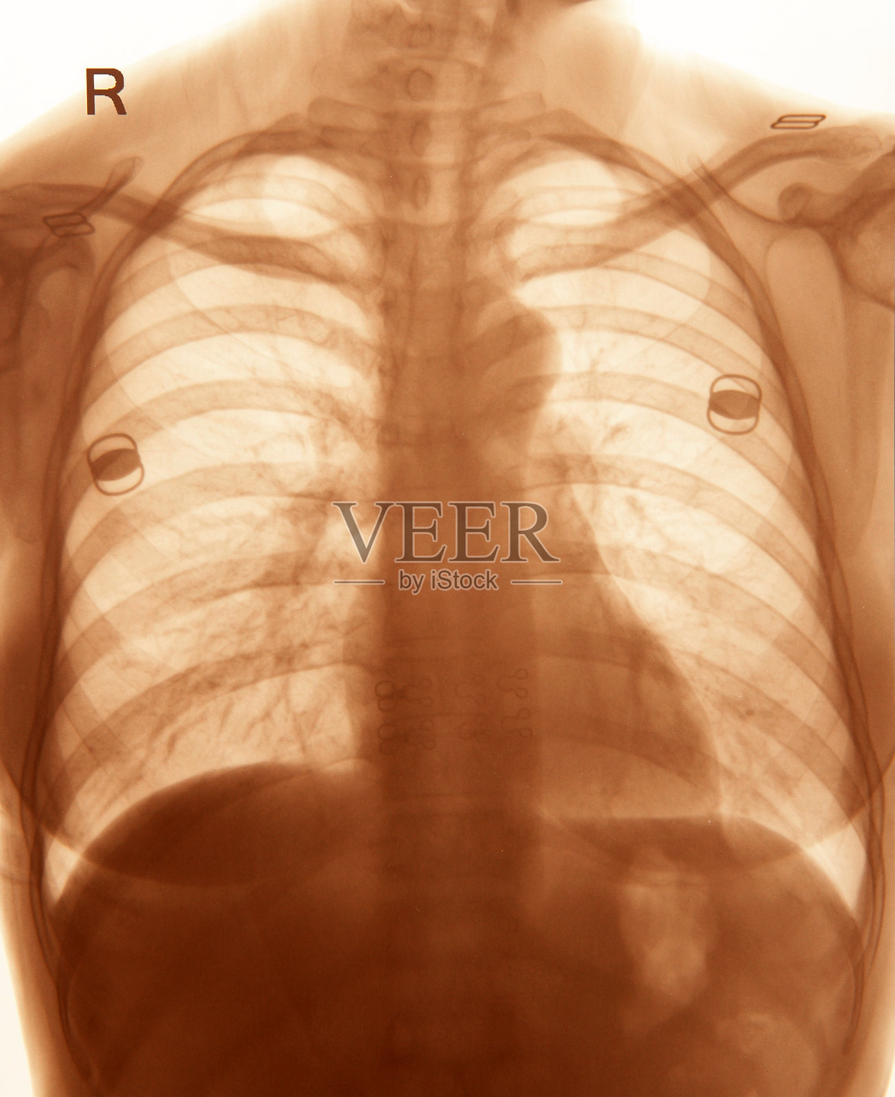 胸部x光图像照片摄影图片