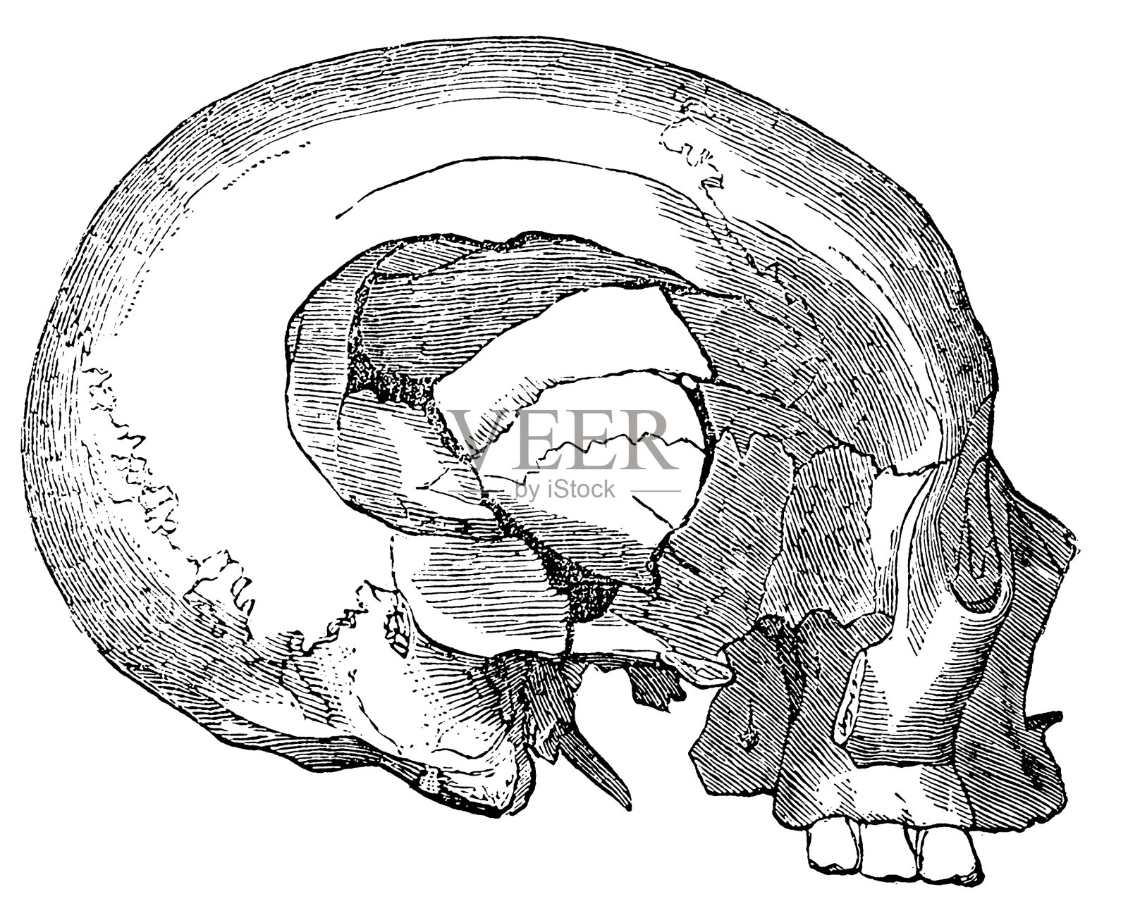 破碎的颅骨插画图片素材