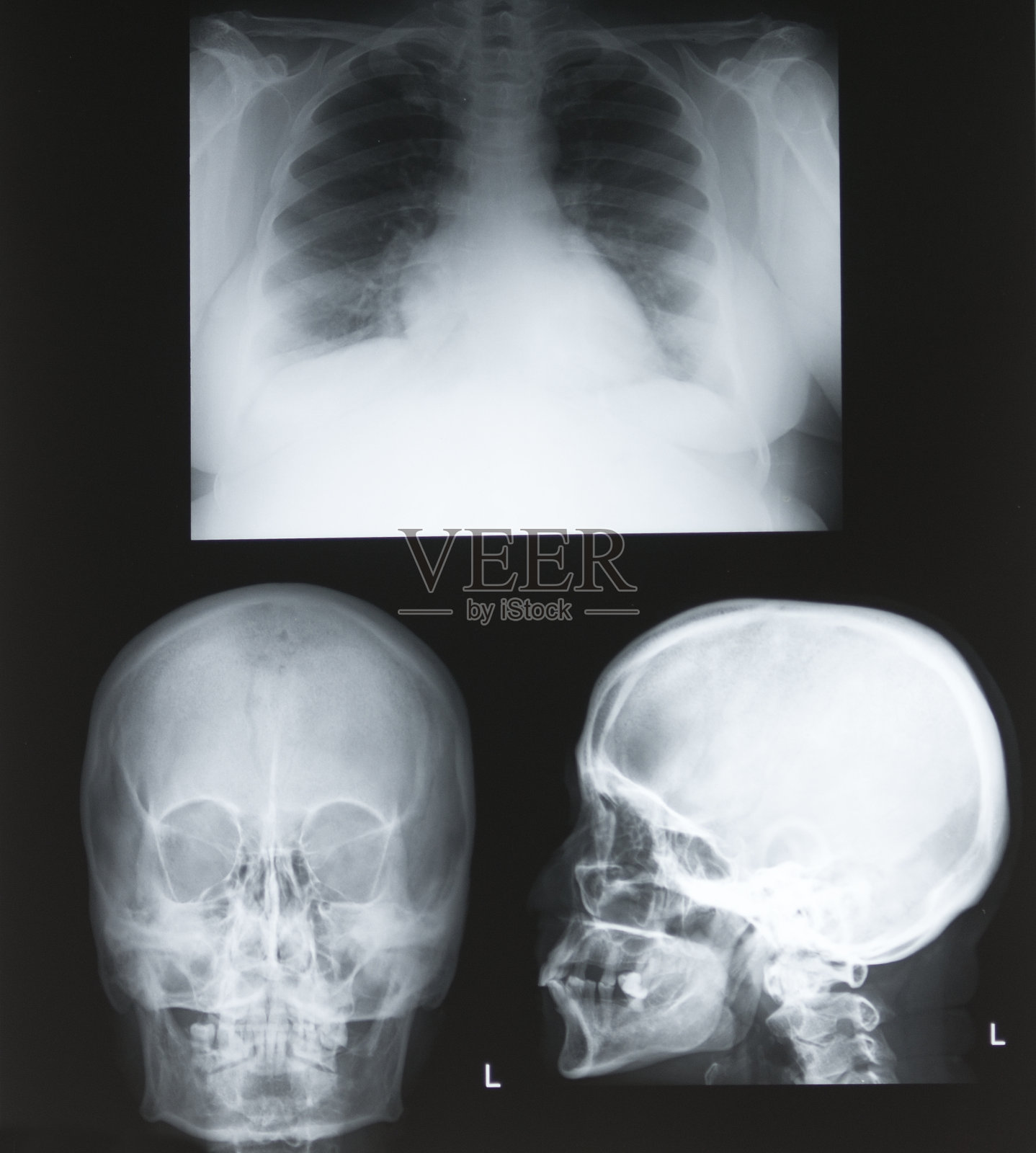 x光照片摄影图片
