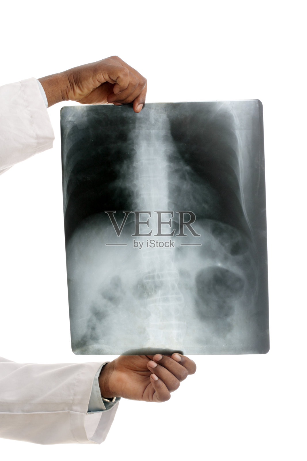 医生正在查看X光片照片摄影图片