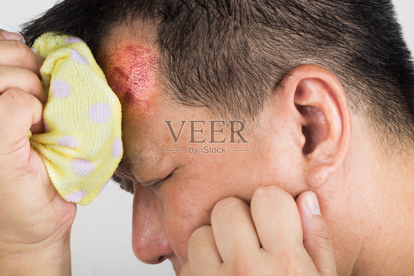 男子治疗他的受伤疼痛肿胀的前额与icep撞照片摄影图片