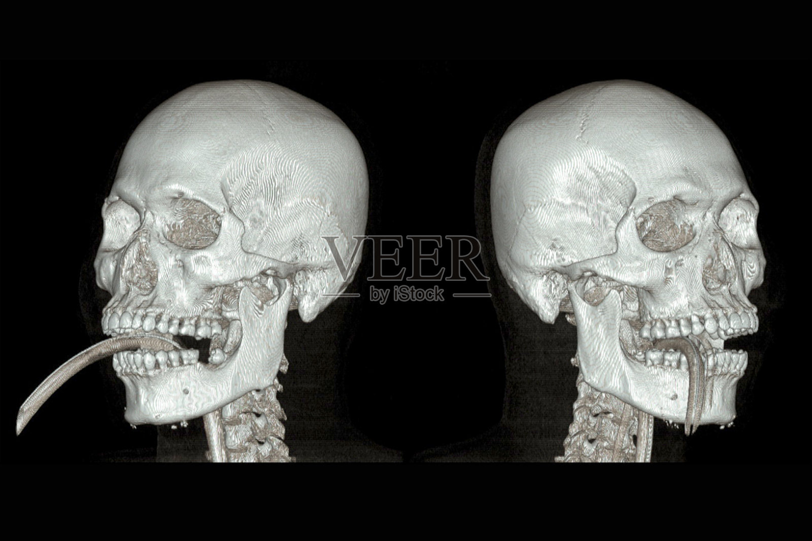 电脑断层扫描大脑的一系列图像照片摄影图片