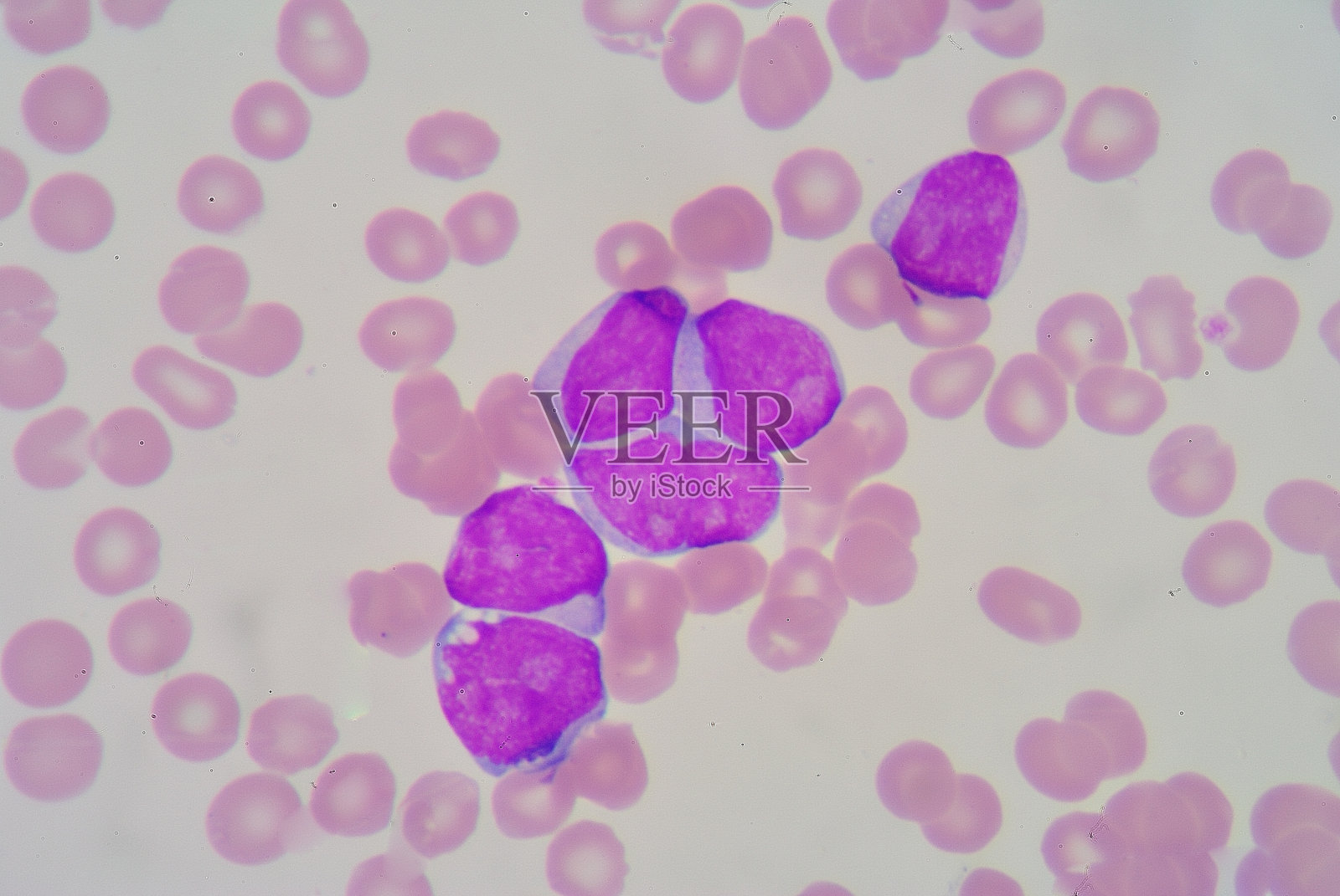 血液涂片上的母细胞照片摄影图片