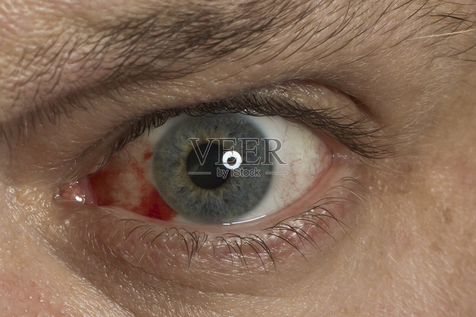 近距离观察红眼照片摄影图片