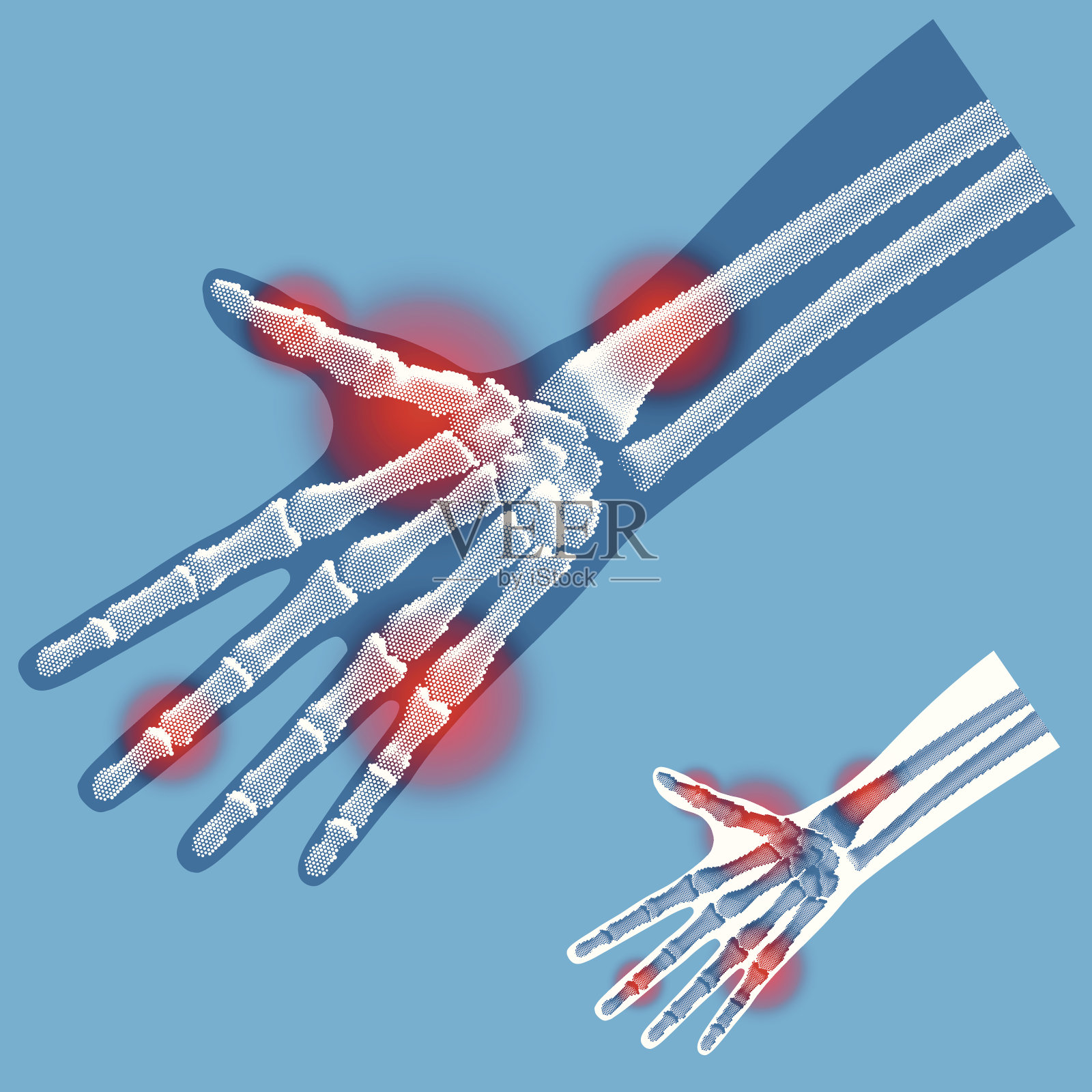 手- x射线前视图插画图片素材