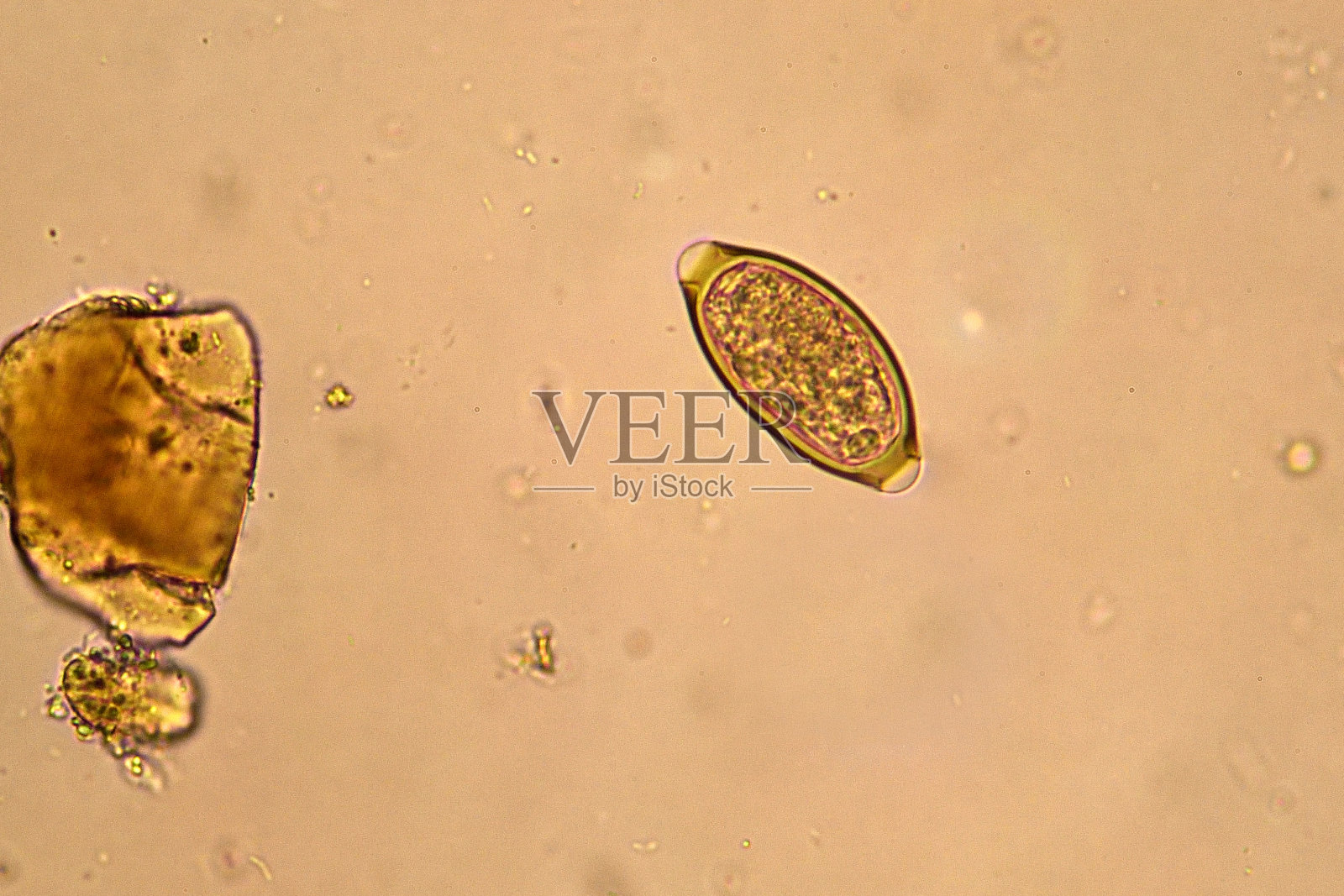 鞭虫trichiura(鞭虫)照片摄影图片