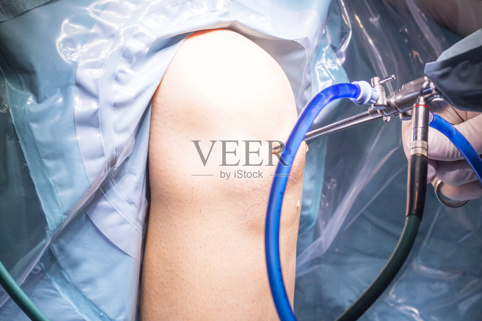 膝关节镜手术在医院手术剧院创伤骨科急诊室的显微手术。照片摄影图片