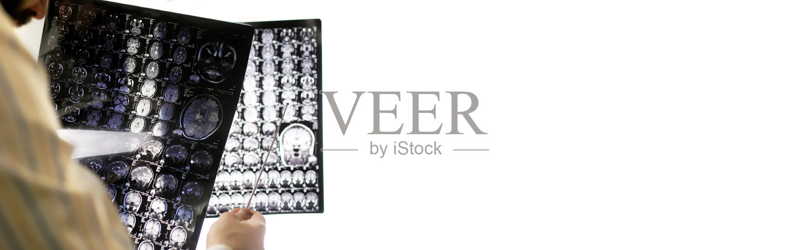 医生拿着一张大脑核磁共振的照片照片摄影图片