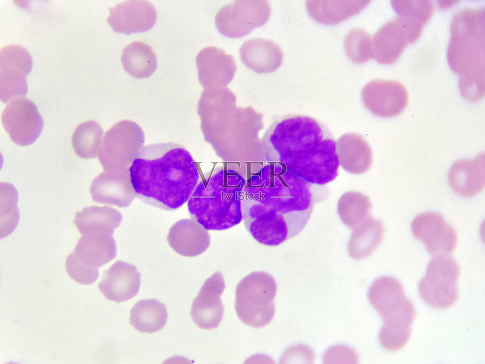 白血病细胞照片摄影图片