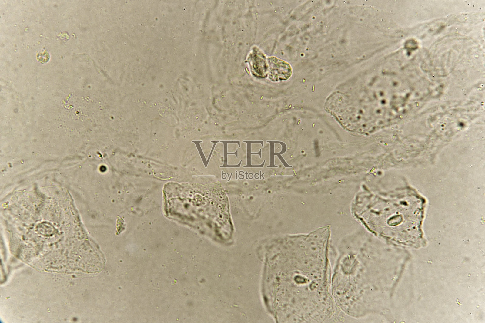 病人尿液中的上皮细胞和细菌照片摄影图片