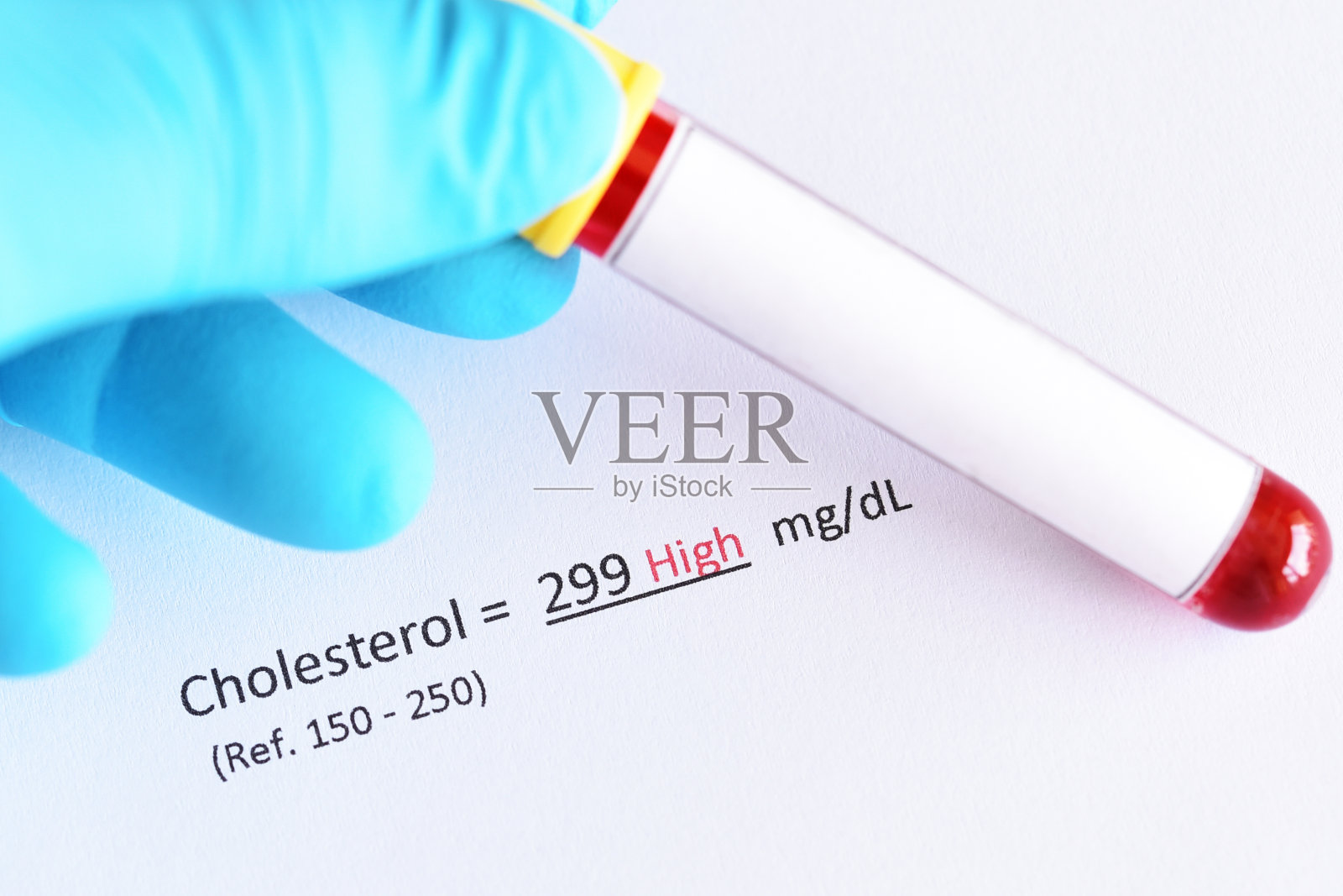 异常高胆固醇测试结果照片摄影图片