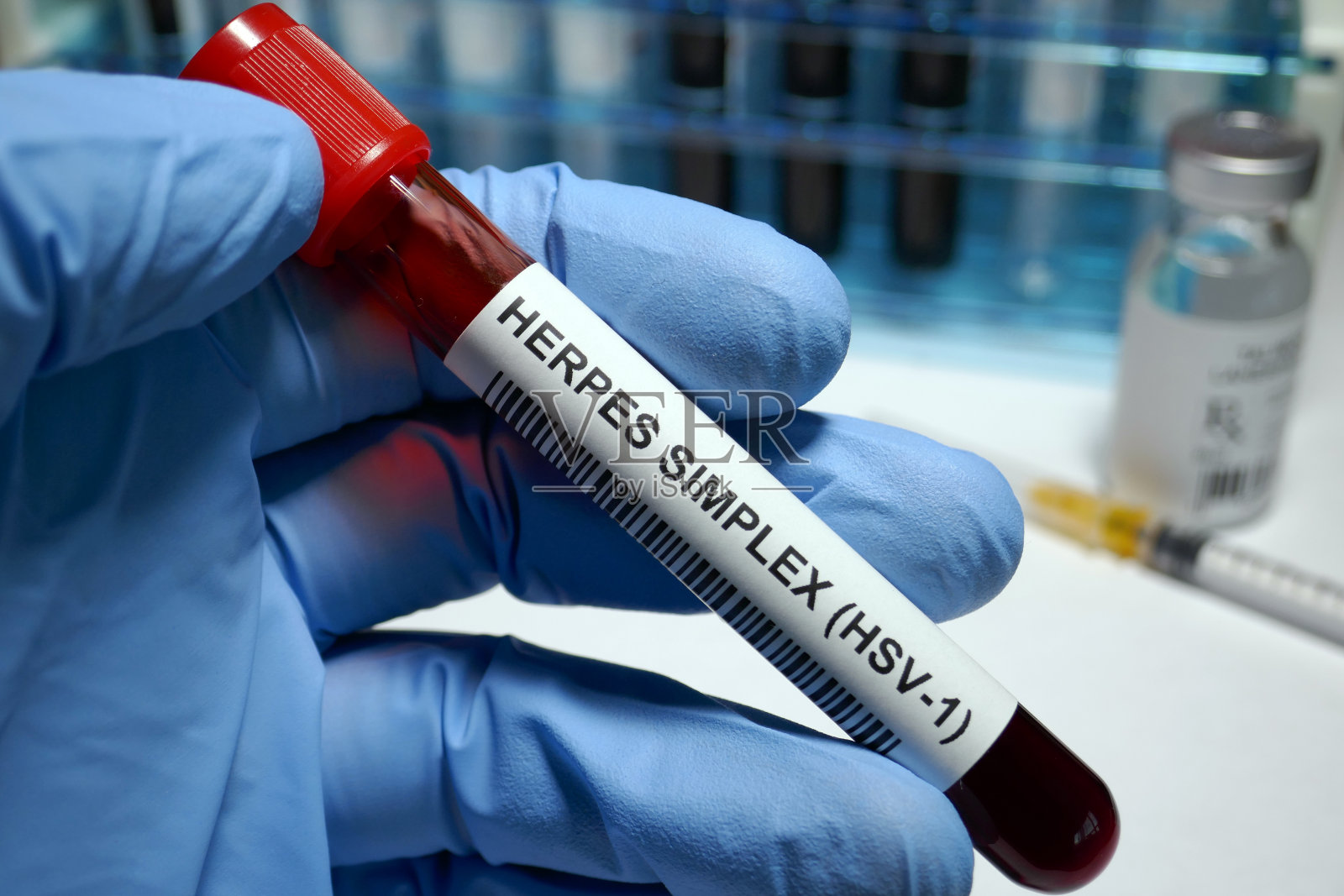 单纯疱疹病毒1治疗照片摄影图片