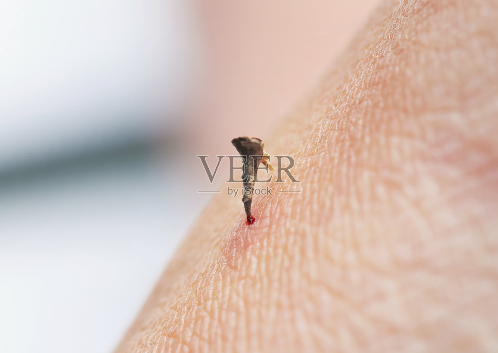 这种植物的尖刺刺进人的皮肤,刺入血液照片摄影图片