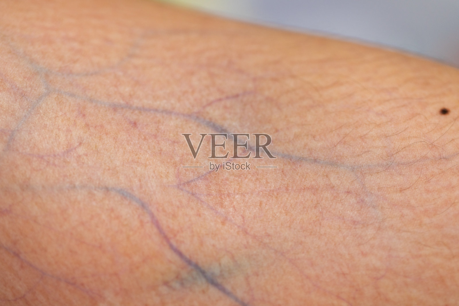 由组织,神经,肌腱组成的实体。照片摄影图片