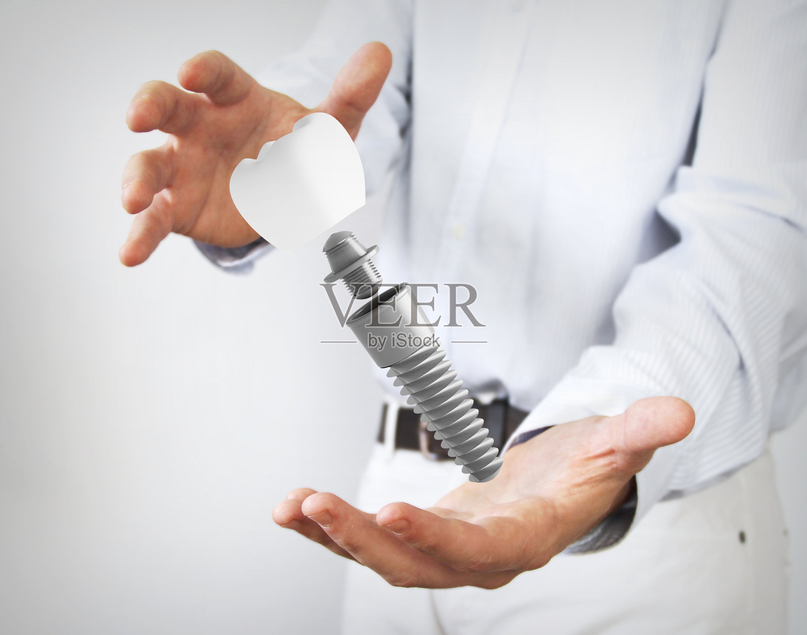 牙科修复术的概念照片摄影图片