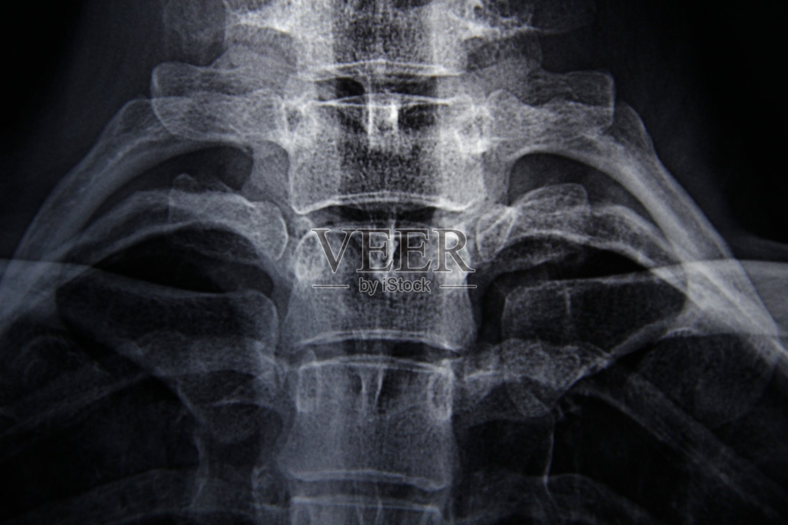 射线照片照片摄影图片