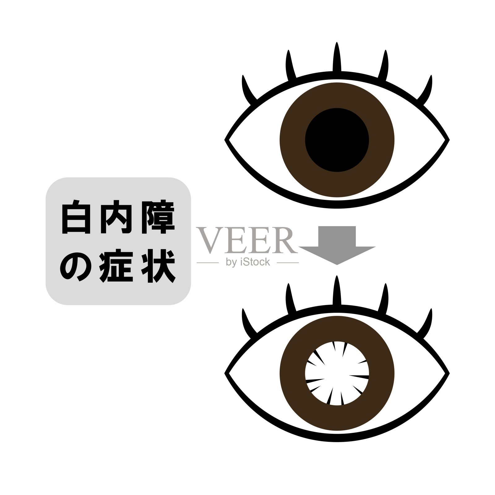 白内障照片摄影图片