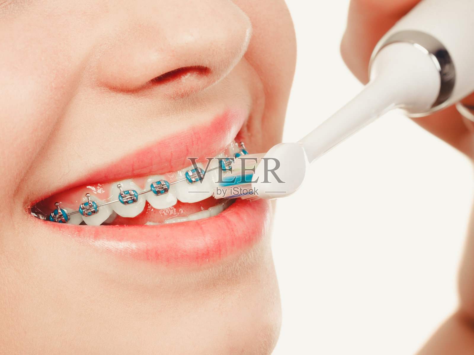 女人微笑着用牙套清洁牙齿照片摄影图片