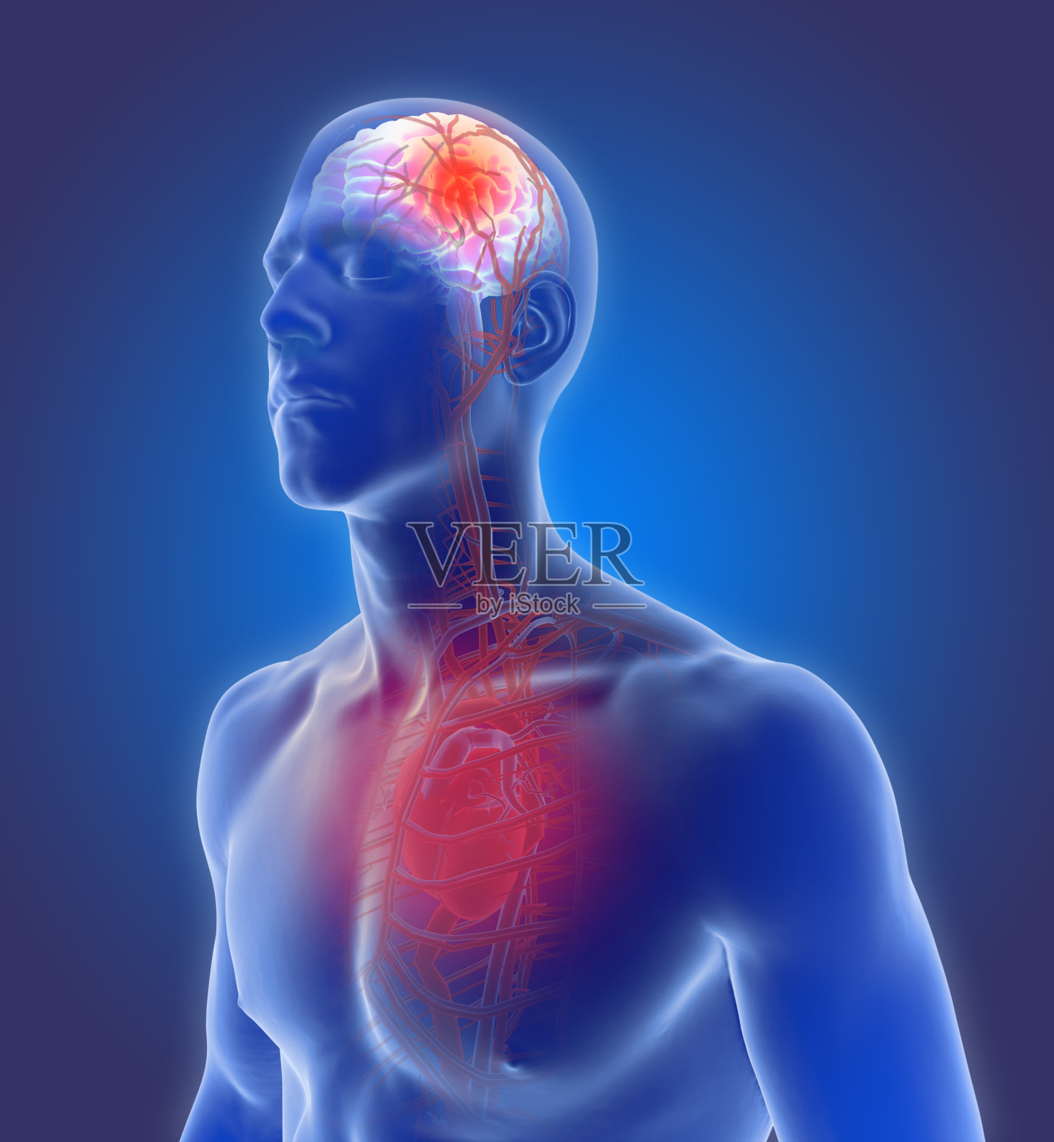 三维图解的血管在人脑和脑血管疾病或出血性中风和脑中风的原因照片摄影图片