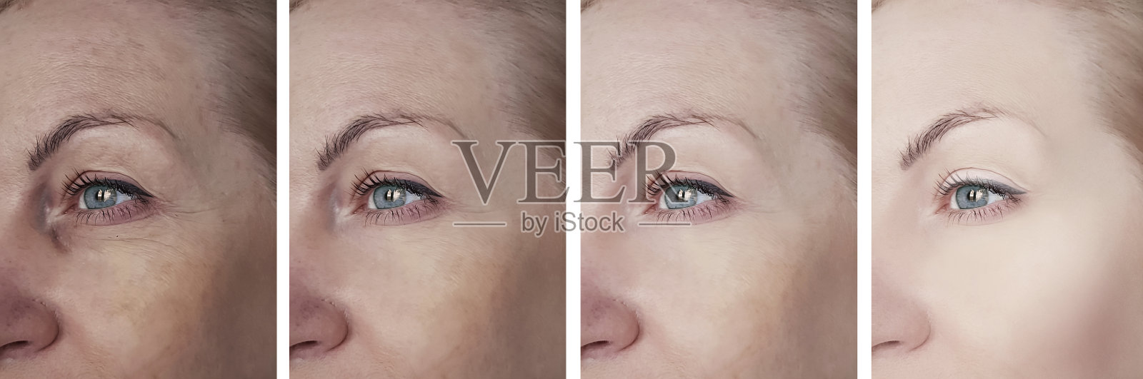 女人的眼部皱纹来了又来了照片摄影图片