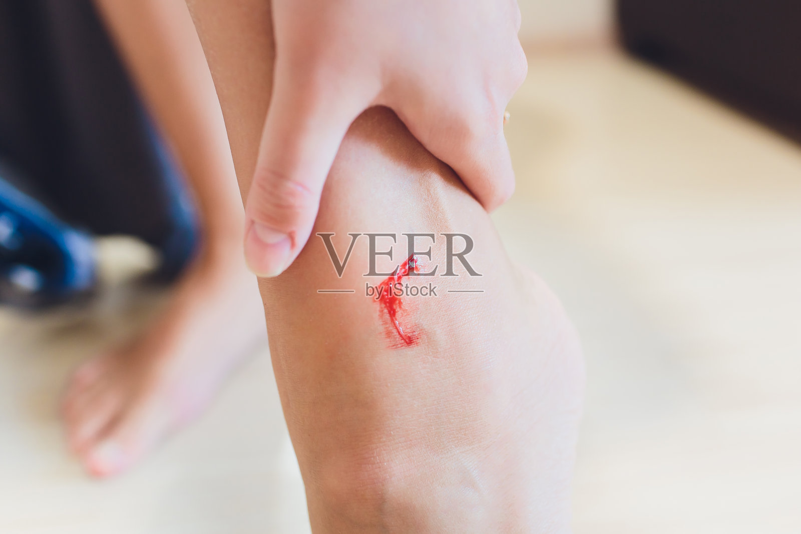 这条腿因抓伤而出血。照片摄影图片