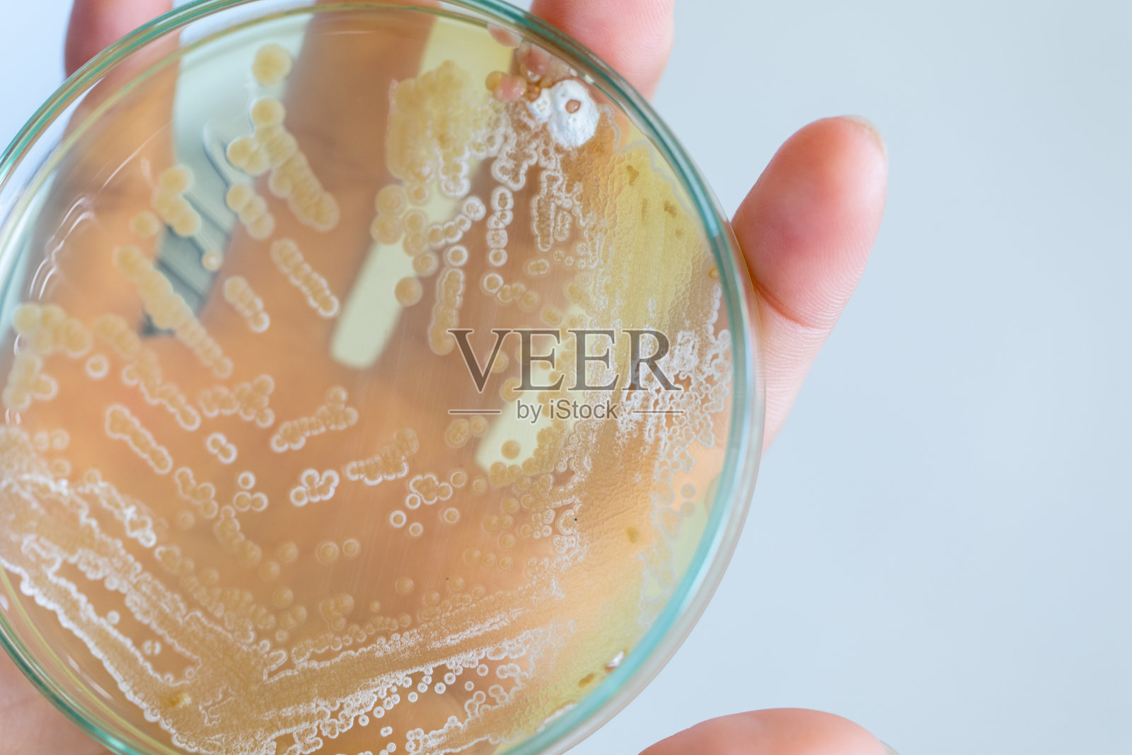 土壤样品琼脂平板上细菌和霉菌的特性及不同形态菌落背景,供微生物学实验室教学之用。照片摄影图片