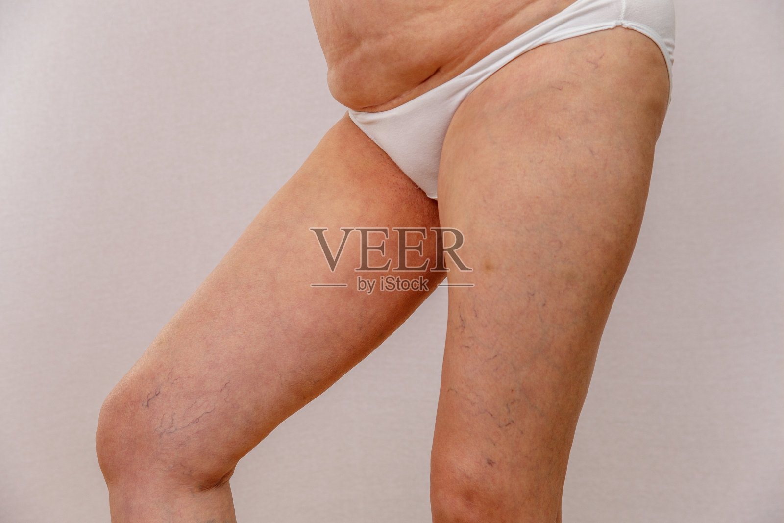 老年妇女的身体照片摄影图片