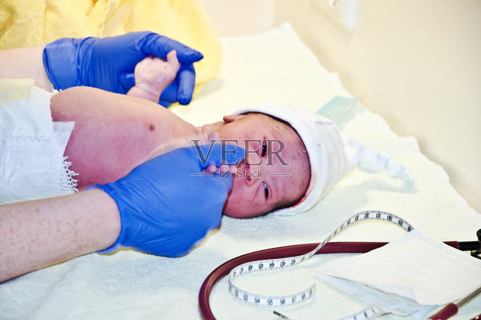 接受首次体检的唐氏综合征新生儿照片摄影图片