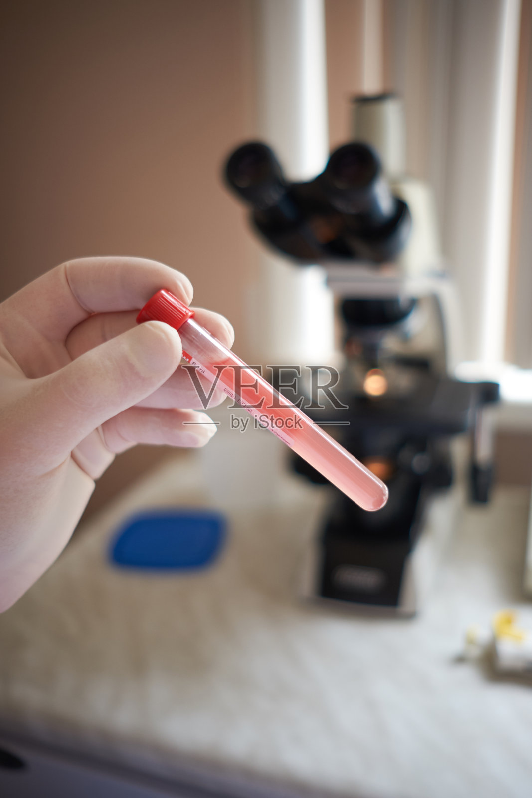 用充满血液的试管,血液显微镜诊断交叉试验Rh照片摄影图片