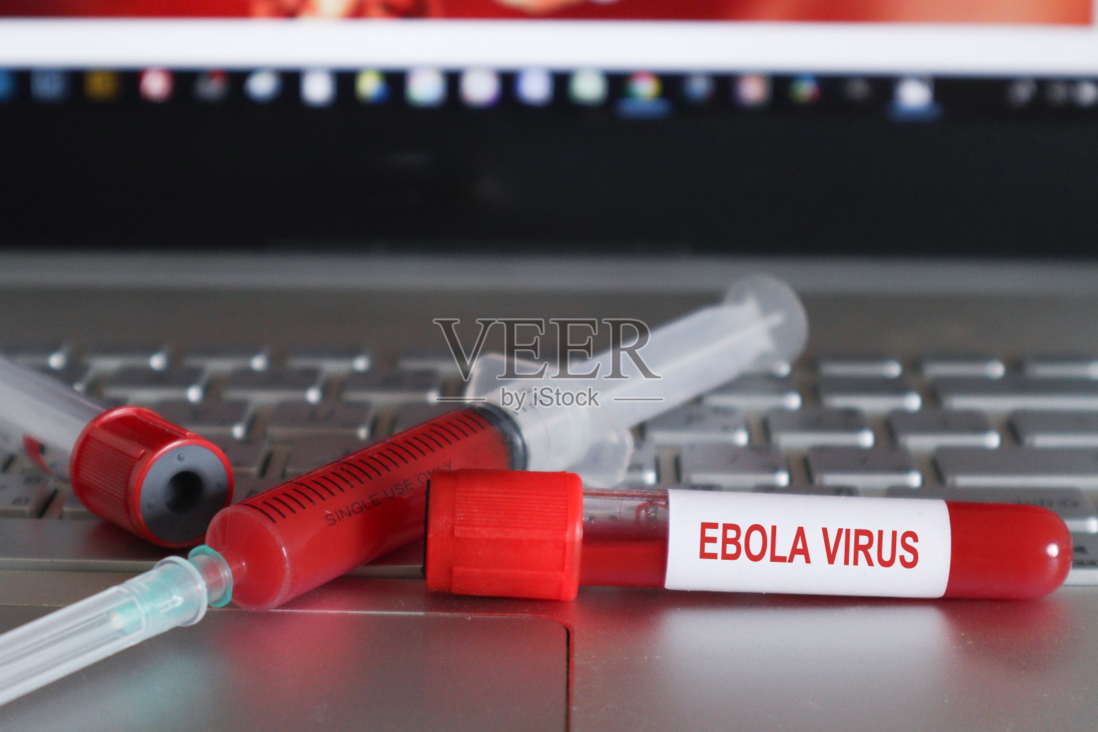 伊波拉病毒病(EVD)是一种人类病毒性出血热。埃博拉是一种罕见的致命疾病,1976年在刚果的埃博拉河附近首次发现照片摄影图片