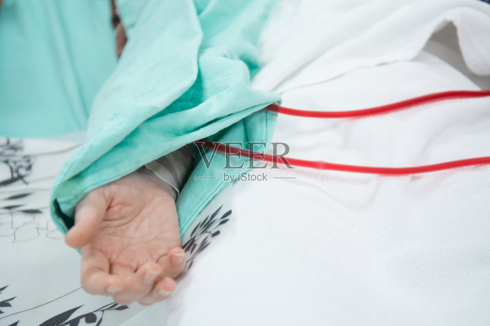 带管子的血液透析机照片摄影图片