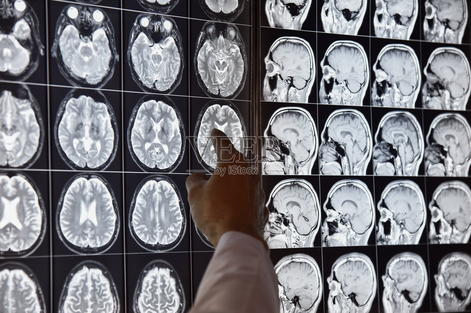 医生在放射科房间指向核磁共振大脑照片摄影图片