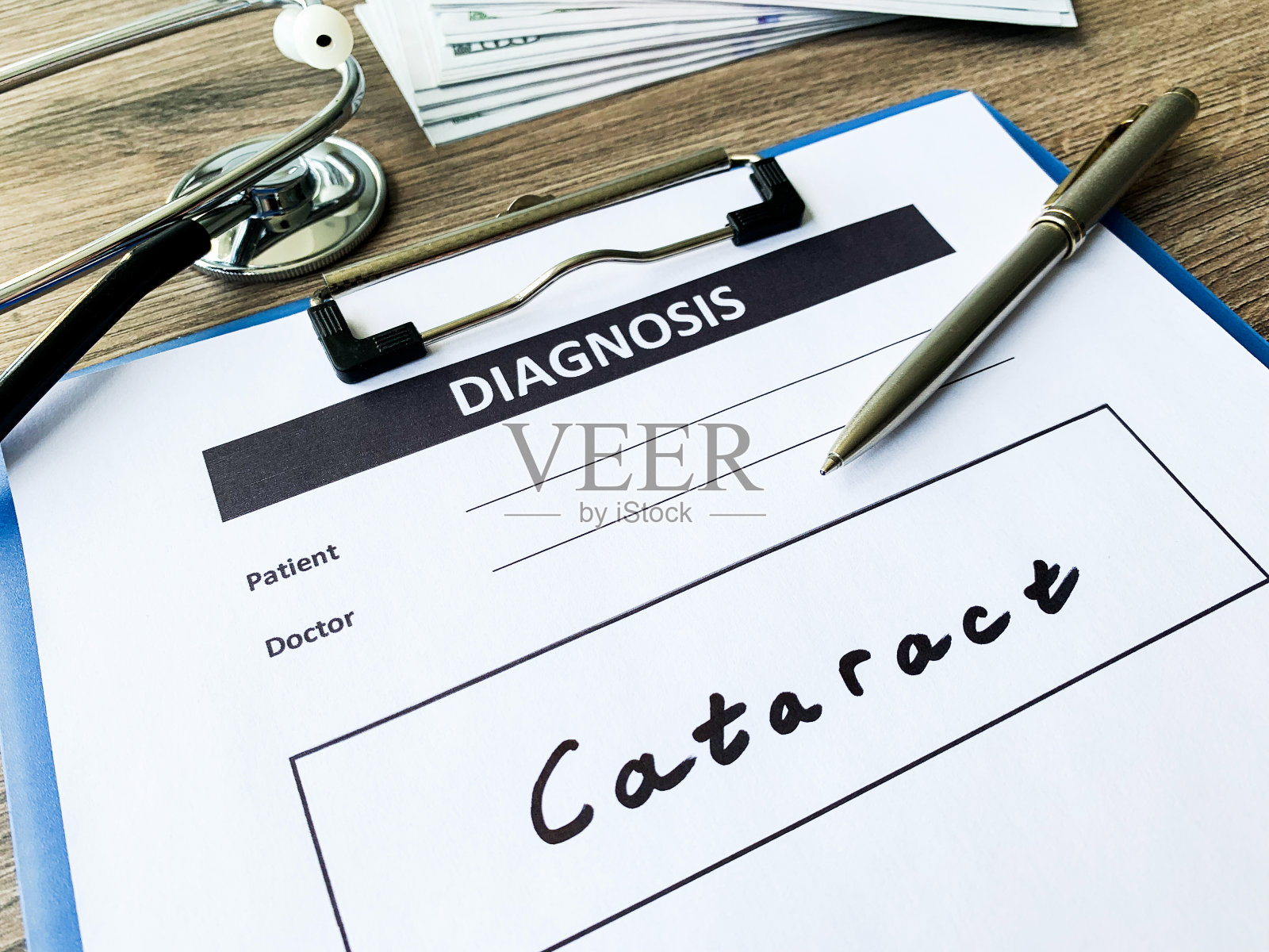 医生桌上的医疗表格上有白内障诊断照片摄影图片