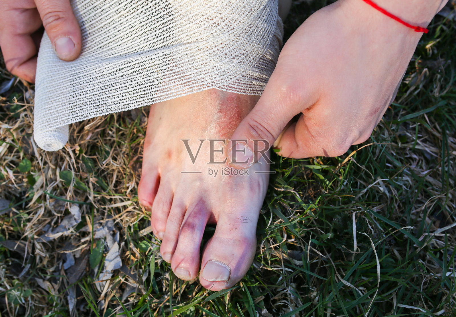 男子正在给扭伤的脚踝包扎。扭曲的腿。坐在大自然中的人。赤脚在草地上。干燥的划痕和伤口。受伤的游客。穿着不舒服的鞋子徒步旅行。脚上的水泡。照片摄影图片