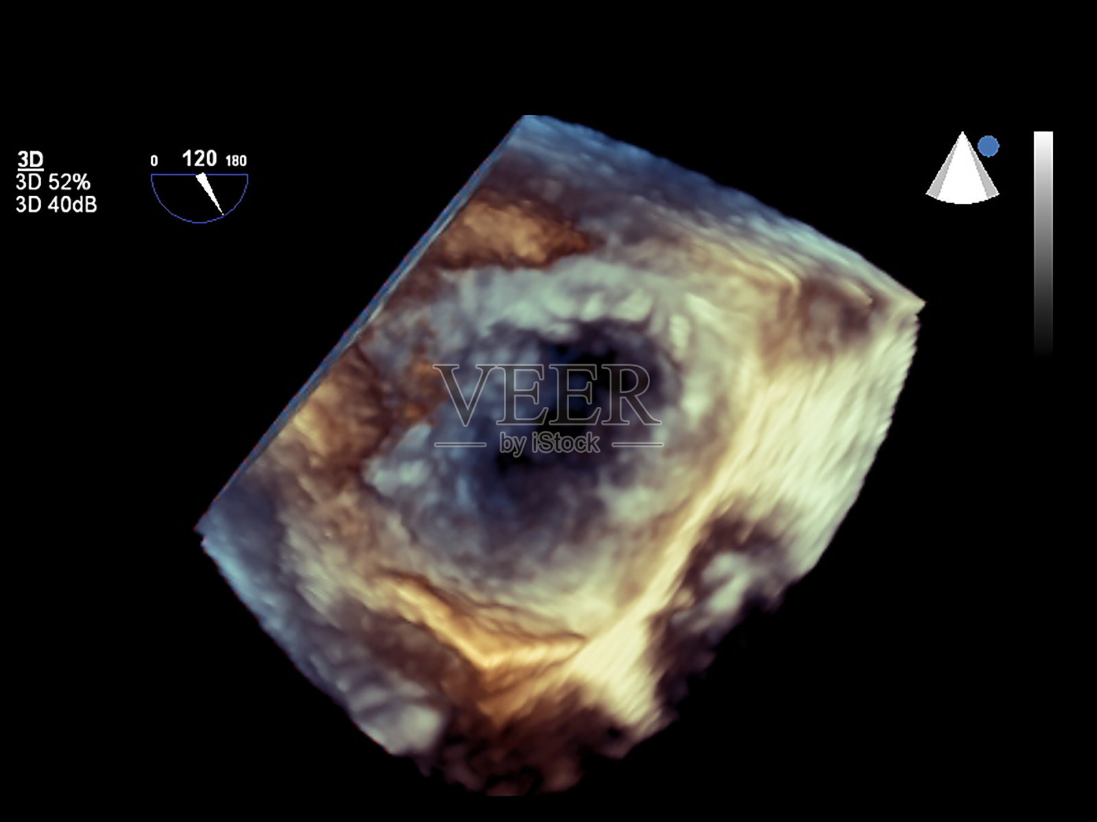 现代3 d超声心动图。照片摄影图片